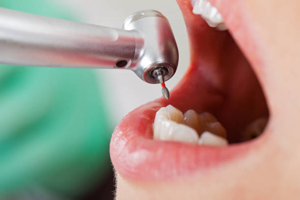 Best Knocked-Out Tooth Emergency  in New Brunswick, NJ